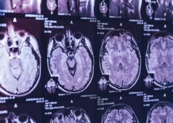 New Brunswick to Give Update on Mysterious Brain Disorder