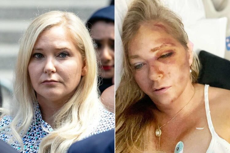 Virginia Giuffre in Critical Condition After Car Crash