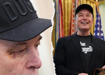 ماسک: پسرم موقع بازی به چشمم زد