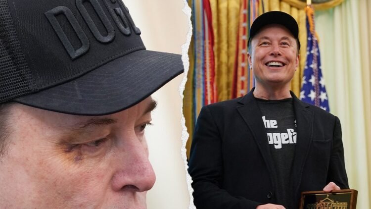 ماسک: پسرم موقع بازی به چشمم زد