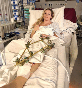 Lindsey Vonn Olympic Recovery Begins