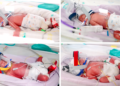 Identical quadruplet girls born