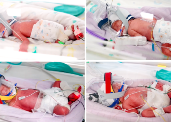 Identical quadruplet girls born