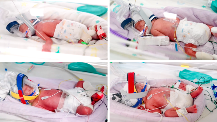 Identical quadruplet girls born