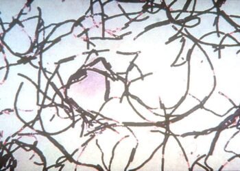 Anthrax Outbreak in Zambia Kills 50 Animals, Infects 12