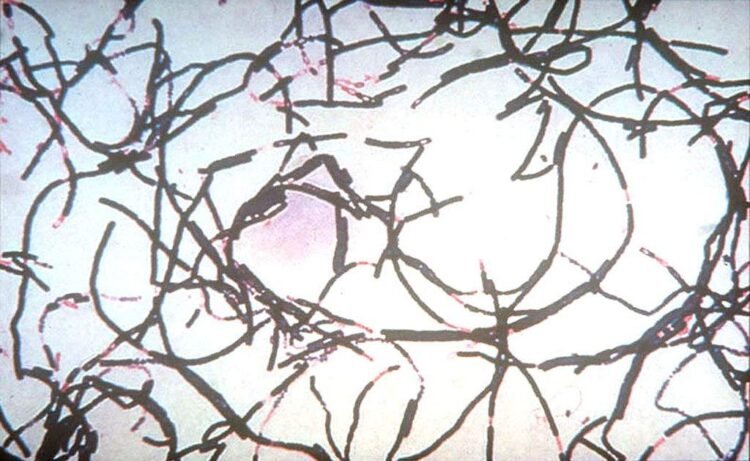 Anthrax Outbreak in Zambia Kills 50 Animals, Infects 12